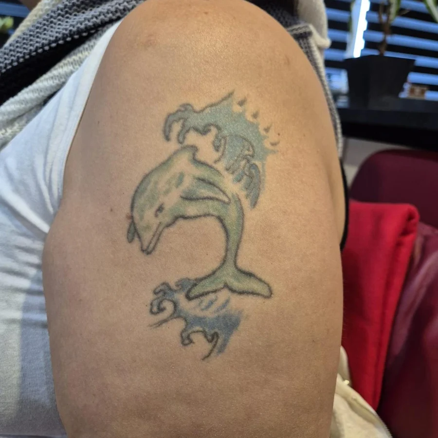 Cover-up einer Jugendsünde - Vorher